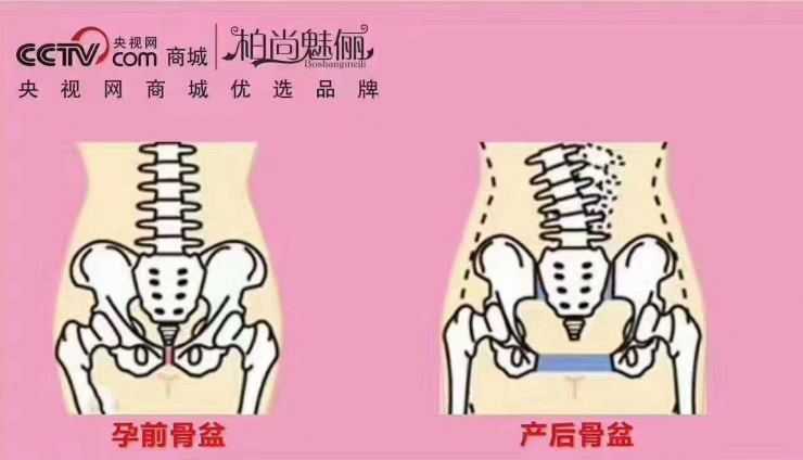 月子中心产后恢复专家 大力推荐 柏尚魅俪塑身